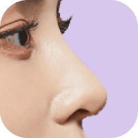 Nose Thumnail Image